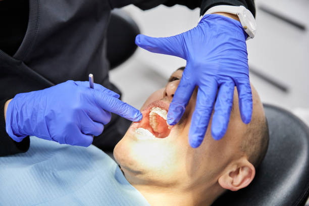 Best Dental Abscess Treatment in Apison, TN