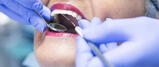 Best Emergency Treatment for Oral Infections in Apison, TN